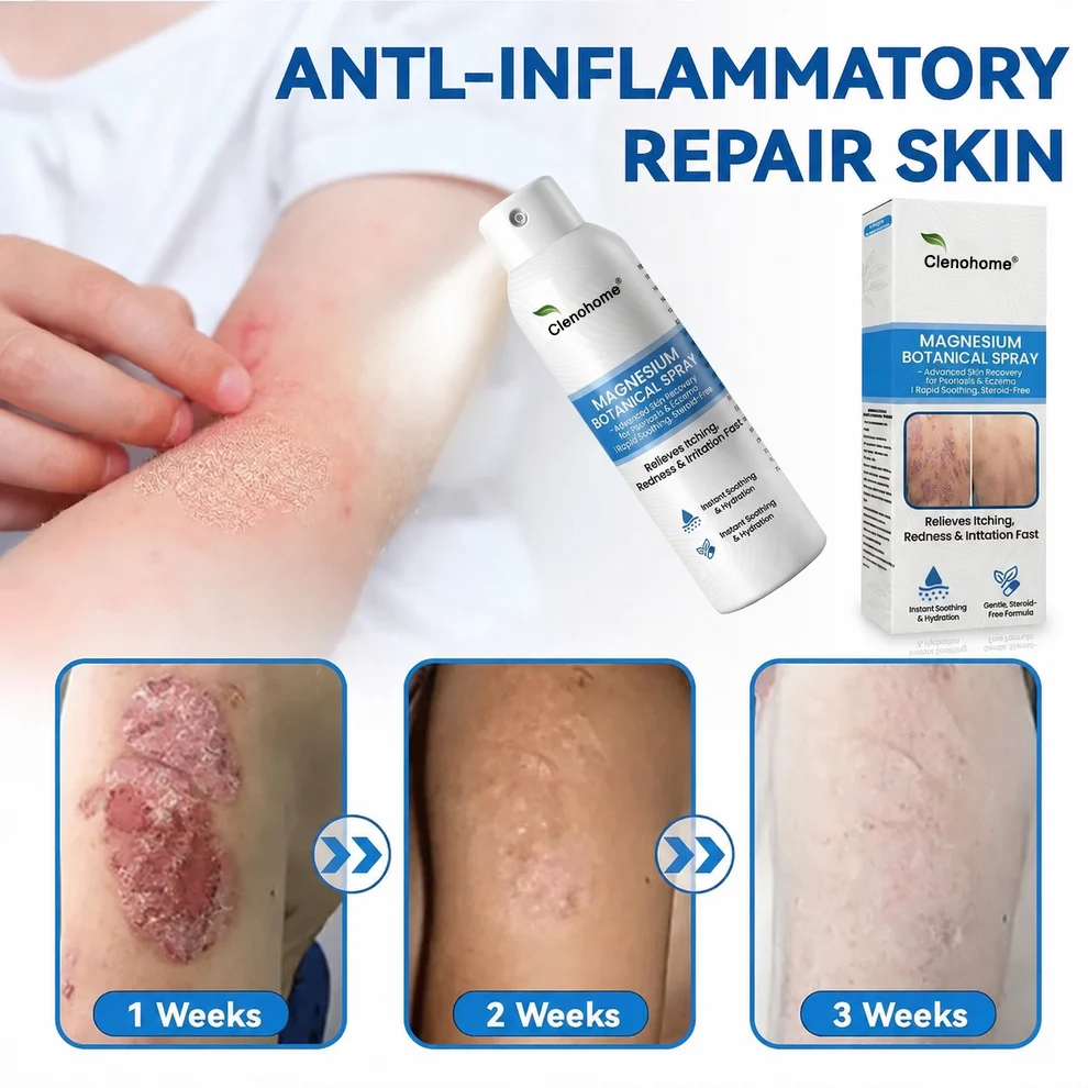 ✨Clenohome® Magnesium Botanical Spray – Advanced Skin Recovery for Psoriasis & Eczema | Rapid Soothing, Steroid-Free