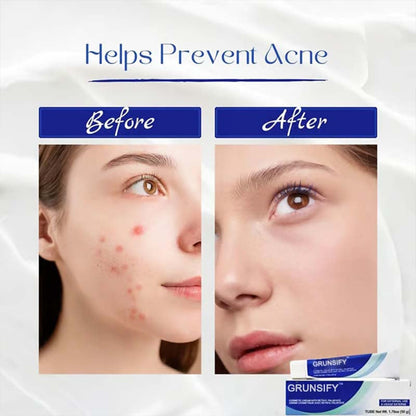 ✨Get clear, radiant skin quickly - Enjoy a 49% discount - ✨Ultimate skincare formula + hyaluronic acid - Designed specifically for seniors