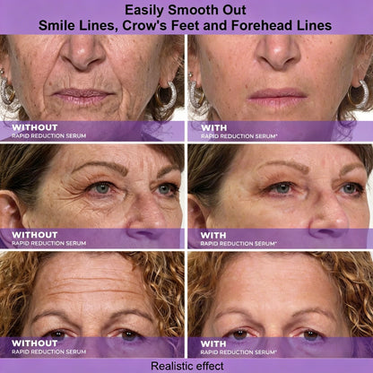Clenohome™ Instant Face Temporary Tightener – Instant visible results in 30 seconds
