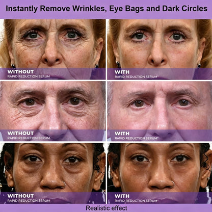Clenohome™ Instant Face Temporary Tightener – Instant visible results in 30 seconds