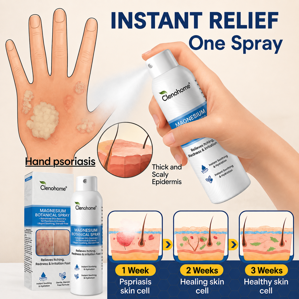 ✨Clenohome® Magnesium Botanical Spray – Advanced Skin Recovery for Psoriasis & Eczema | Rapid Soothing, Steroid-Free